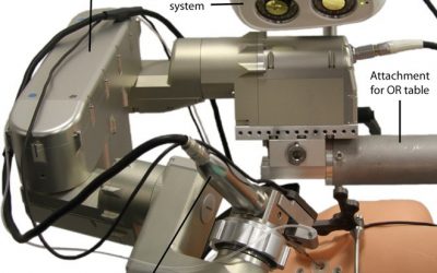 Seriously, this skull-drilling robot is good news for humanity