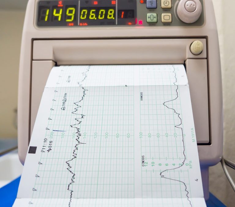 How to Monitor the BCH Stress Test and Get Involved
